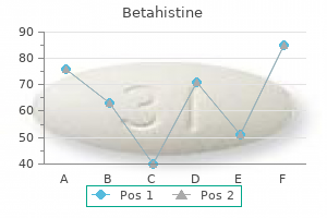 effective betahistine 16 mg