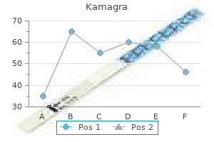order kamagra 50 mg