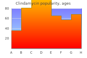 generic clindamycin 150mg