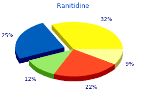 quality 150 mg ranitidine