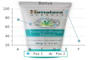 150 mg boniva